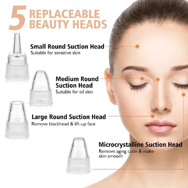 5-in-1 Blackhead Remover - Minichowk